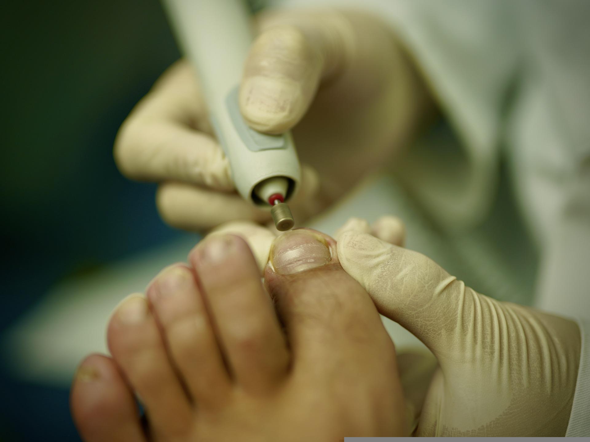 Podiatrist Marietta Ga – Services Offered By A Podiatrist