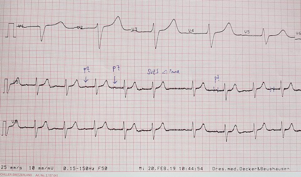 Samsung ECG: A Comprehensive Guide