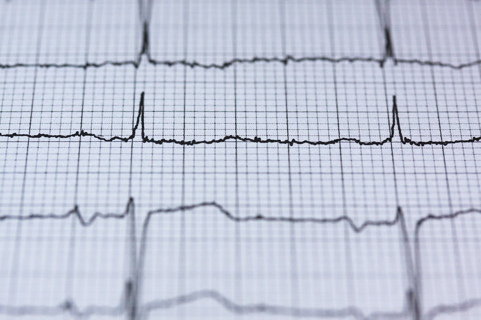 What’s The Difference Between SVT And VTACH?